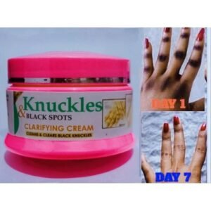 Skin Beauty Fast Effective Knuckles And Dark Spot Removal Cream