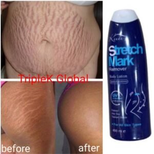 Kuu Stretch Mark Remover Perfume Lotion.