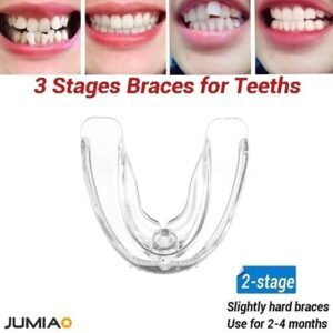 3 Stages Teeth Corrector Bend Brace Aligner -2 Stage