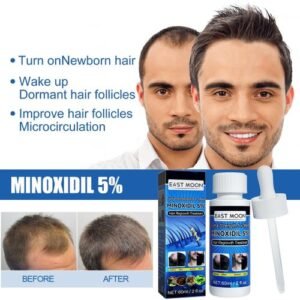 Minoxidil Hair Treatment - Hair Growth - Beard And Hair Growth