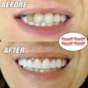 Instant Smiling Braces False Teeth Dental Veneers  Tooth Cover