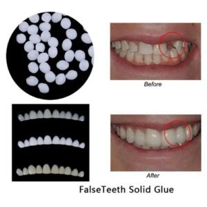 3pcs Denture Teeth Veneers With Thermal Fitting Beads Temporary