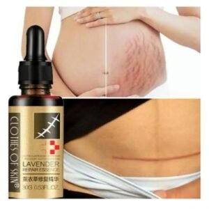 Lavender Repair Essential Oil - Effective Scar Removal Serum